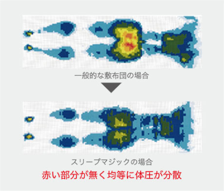 体圧分散